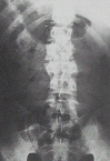 Spine